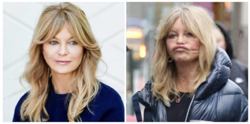 Dopo un lifting del viso, la celebrità di 77 anni, Goldie Hawn, non è più riconoscibile: ha stupito tutti